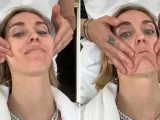 Chiara Ferragni sans maquillage : le massage facial est autocritique